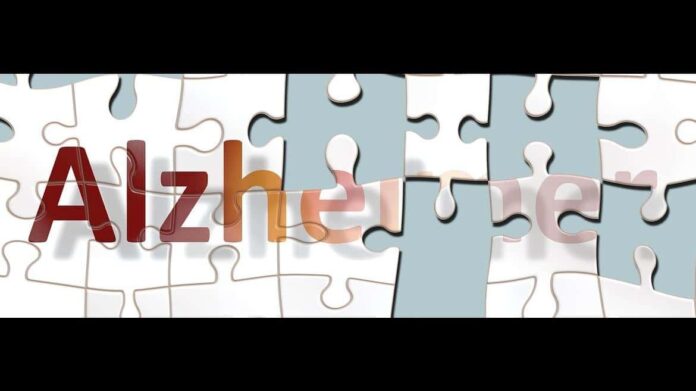 Piezas de puzzle