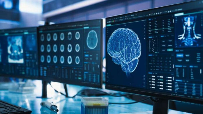 estudio del cerebro humano