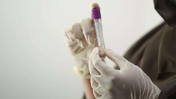 Prueba de sangre