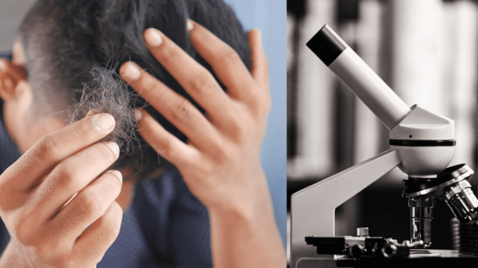 Imagen de una persona con pelo en la mano y un microscopio