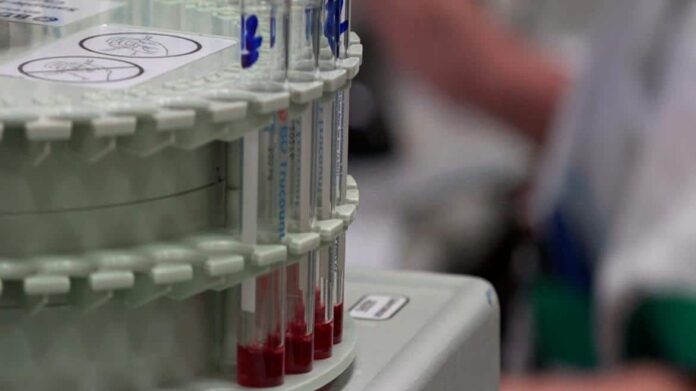Tubos de sangre en un laboratorio