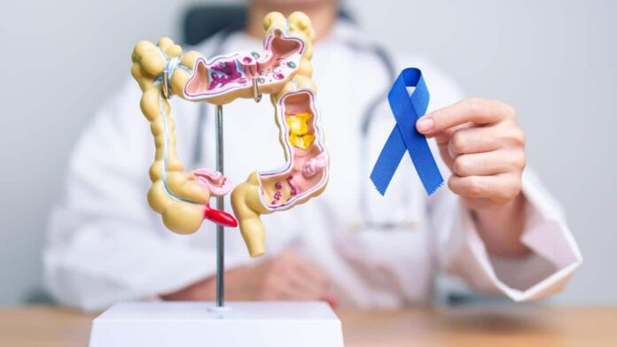 Profesional sanitario en la Detección Precoz de Cáncer de Colon y Recto 