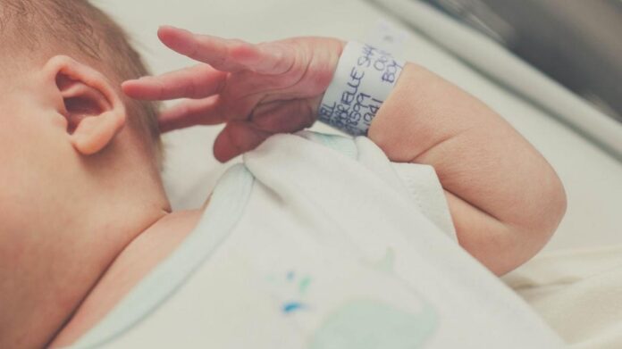 Bebé con defecto congénito de cuatro dedos en una mano