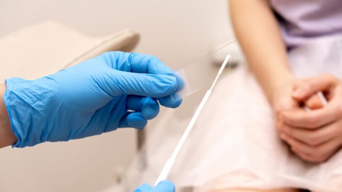 manos profesional sanitario citología mujer