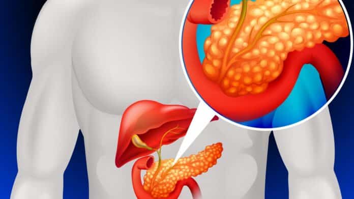 estudio cáncer de pancreas