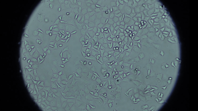 imagen de microscopio de celulitas
