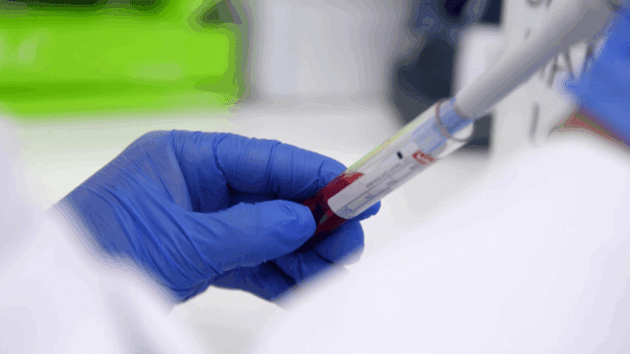 Mano con guante azul que sostiene un tubo mientras una pipeta lo llena de sangre
