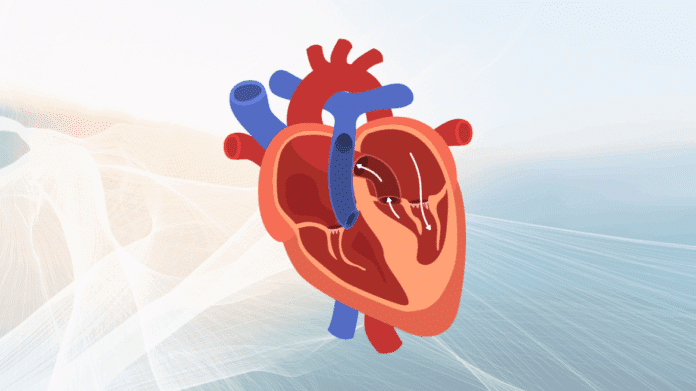 miocardiopatía hipertrófica