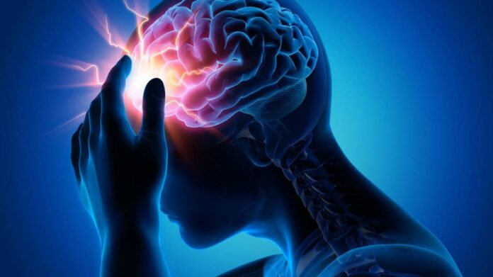 Accidente cerebro vascular