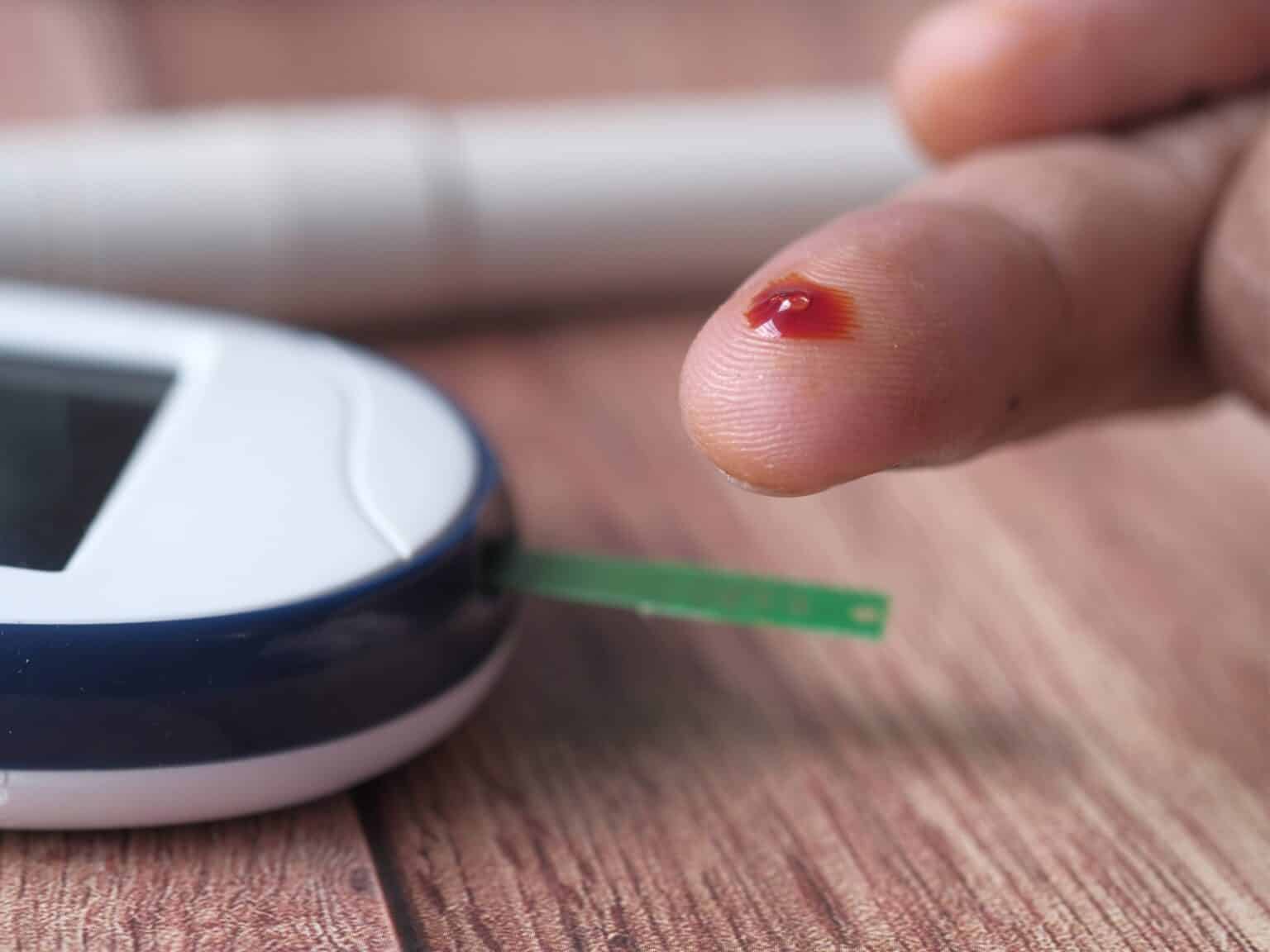 Anticoagulación Eficaz: Estrategias Clave para Reducir Riesgos Cardiovasculares