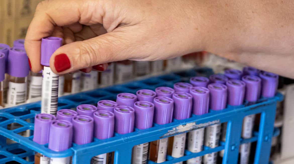 Una mano recoge un tubo de muestra de sangre