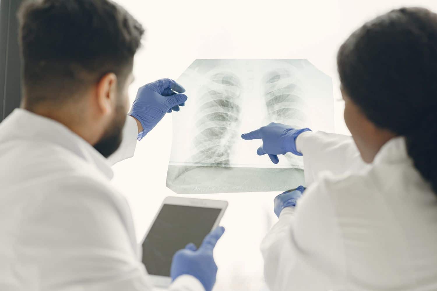 Los tratamientos personalizados y la radioterapia adaptativa marcan una nueva era en el abordaje del cáncer de pulmón