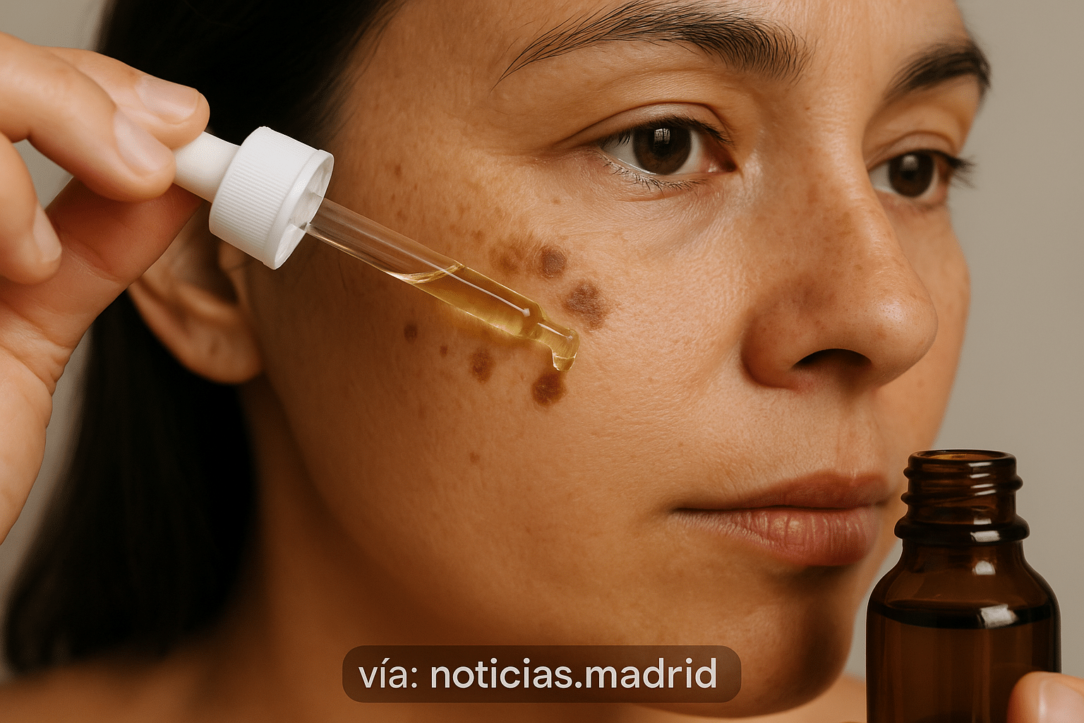 ¿Es seguro utilizar aceite de ricino para mejorar las manchas en la piel?