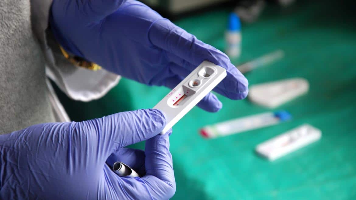 Incremento del 8% en la Atención de la Red de Prevención de ITS en la Comunidad de Madrid