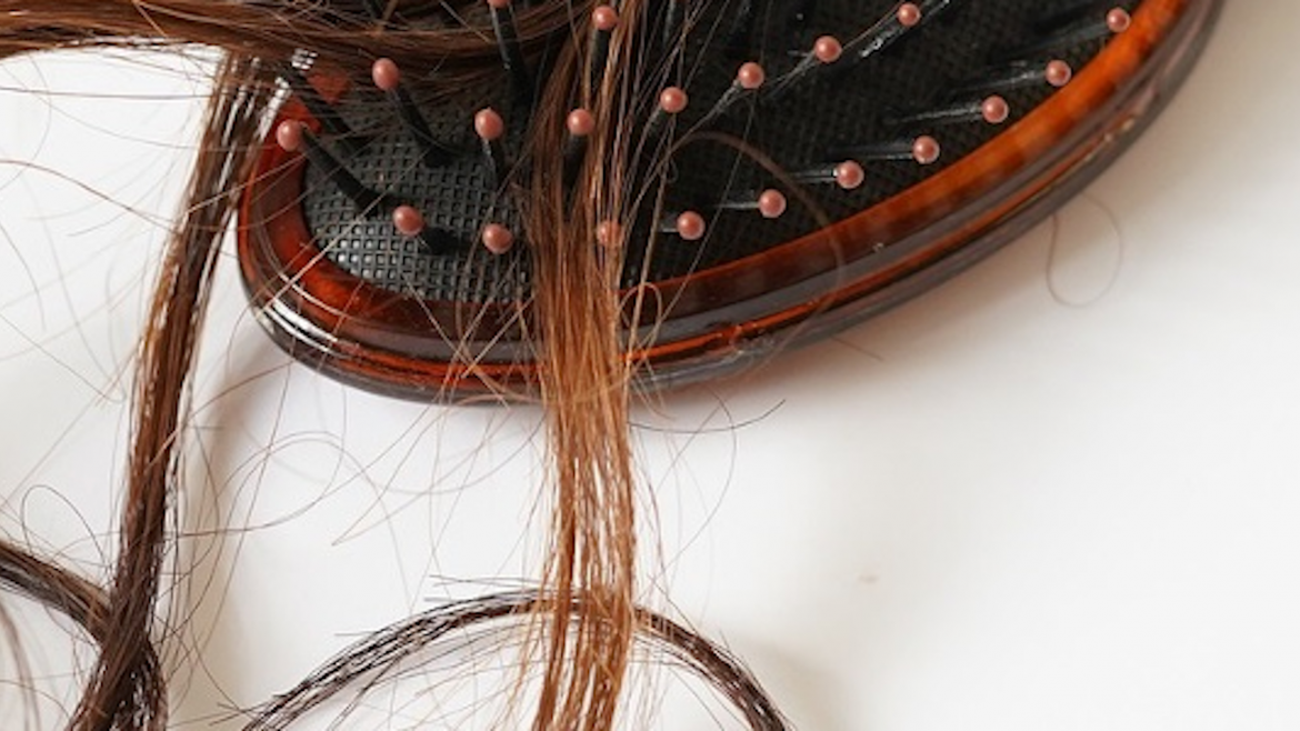 El Hospital Ramón y Cajal: Centro Global de Innovación en Tratamientos para la Alopecia