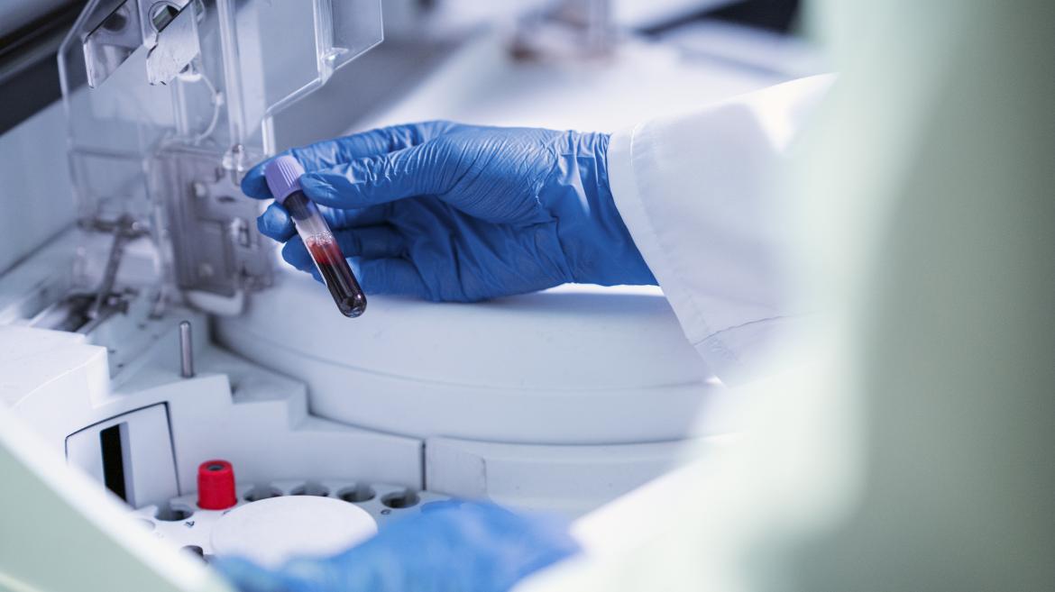 Hospital Ramón y Cajal Recibe Prestigioso Premio por Innovador Proyecto de Terapia Celular en Pacientes
