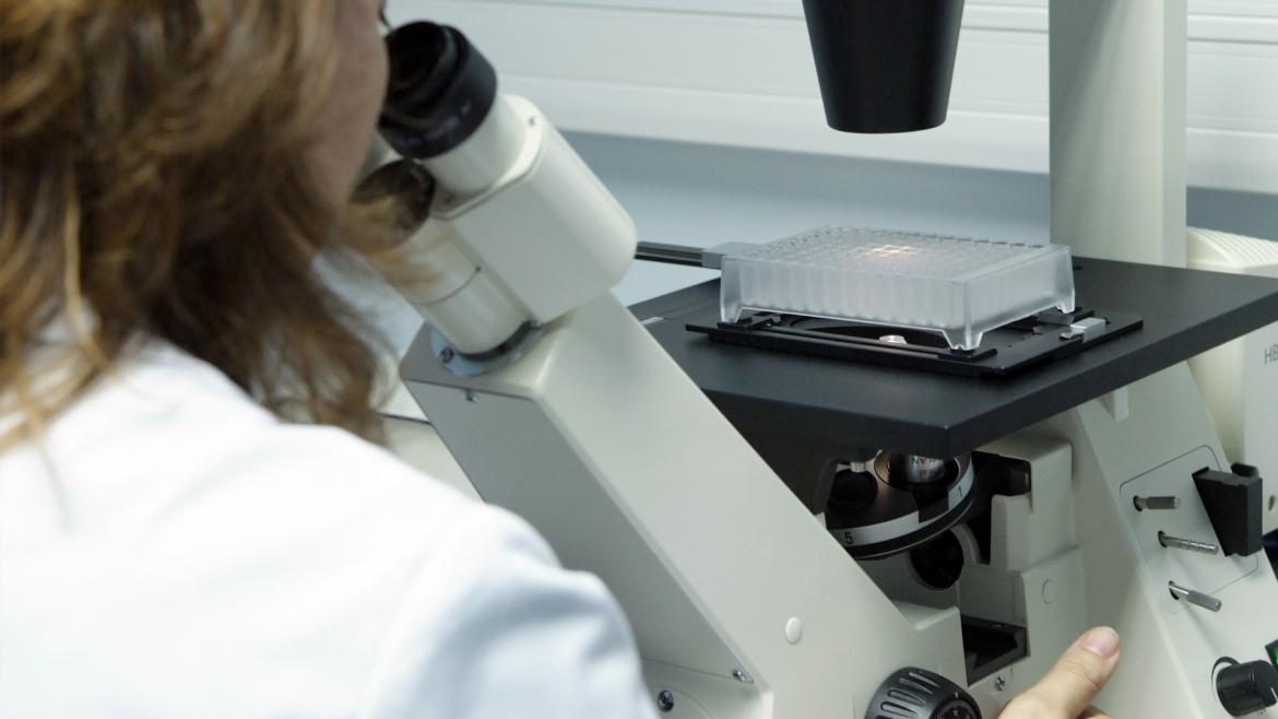 Innovadora Terapia Combinada para Cáncer de Pulmón Microcítico es Avalada por el Hospital Gregorio Marañón