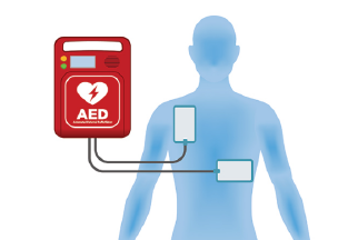 Optimización de Localización de Desfibriladores: Innovación Universitaria en Salud Pública en Madrid