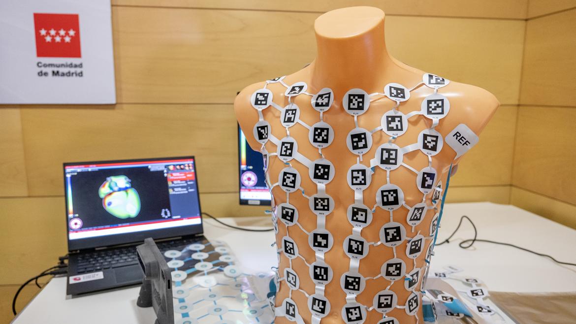 Innovador Sistema de Mapeo Cardíaco del Hospital Gregorio Marañón Llega a EE.UU. Tras Aprobación de la FDA