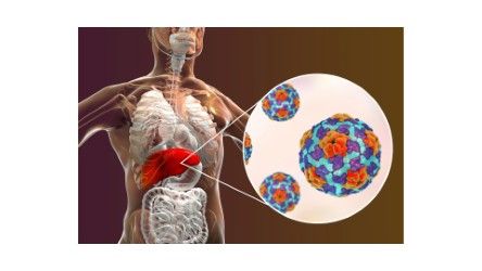 Detección Oportuna de Hepatitis: La Importancia de una Prueba Sencilla para Prevenir Complicaciones