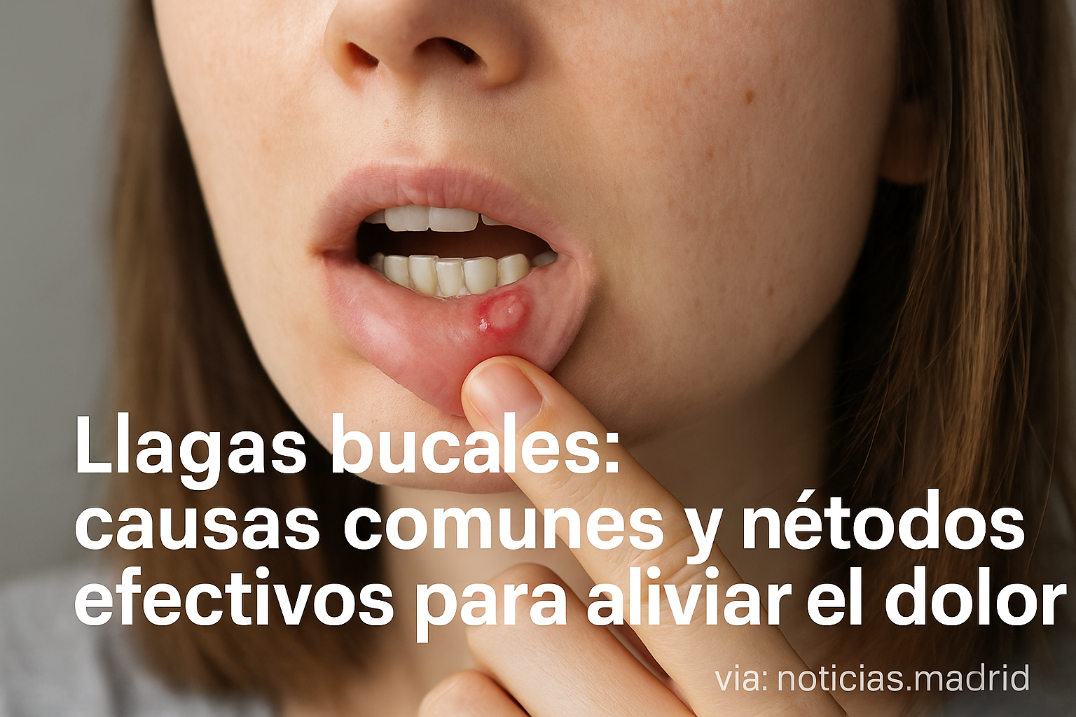 Llagas bucales: causas comunes y métodos efectivos para aliviar el dolor