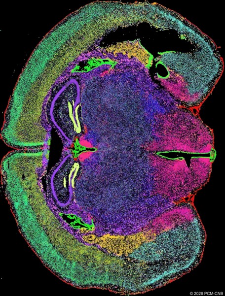 El PCM Revoluciona la Investigación Biomédica con su Innovador Servicio de Transcriptómica Espacial en Colaboración con STOmics y MGI