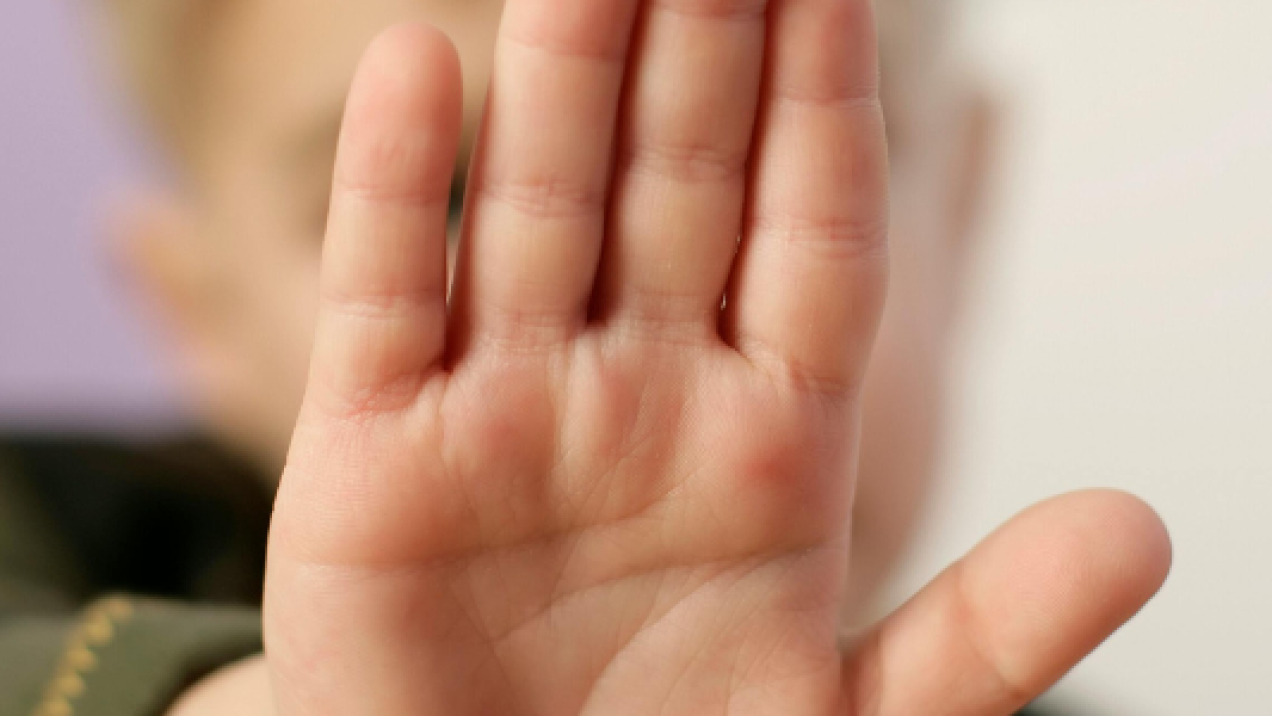 Madrid invierte 1,1 millones en apoyo psicológico para hijos de víctimas de violencia de género 1 Madrid invierte 1,1 millones en apoyo psicológico para hijos de víctimas de violencia de género